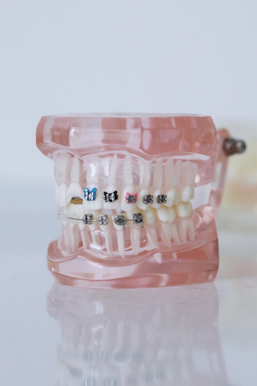 Deep Dental Clinic best braces doctor in Punjab illustration for Best Braces Doctor in Punjab: Discover Deep Dental Clinic’s