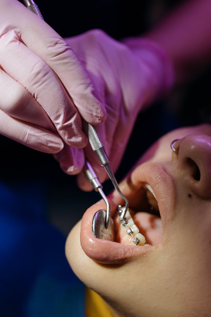 Deep Dental Clinic for braces treatment in Punjab illustration for Braces Treatment at Deep Dental Clinic Punjab: Best Expert