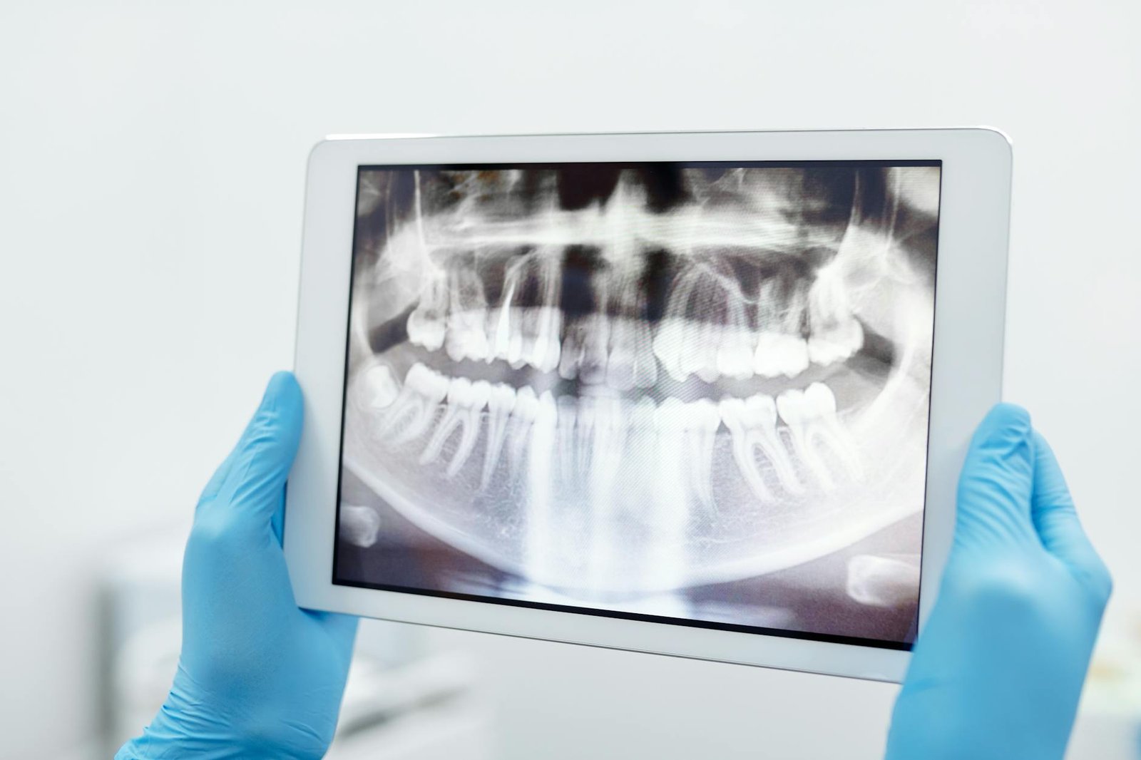 Illustration of Dental X Ray Mohali: Exclusive Guide to Safe Digital Dentistry in Sahibzada Ajit Singh Nagar