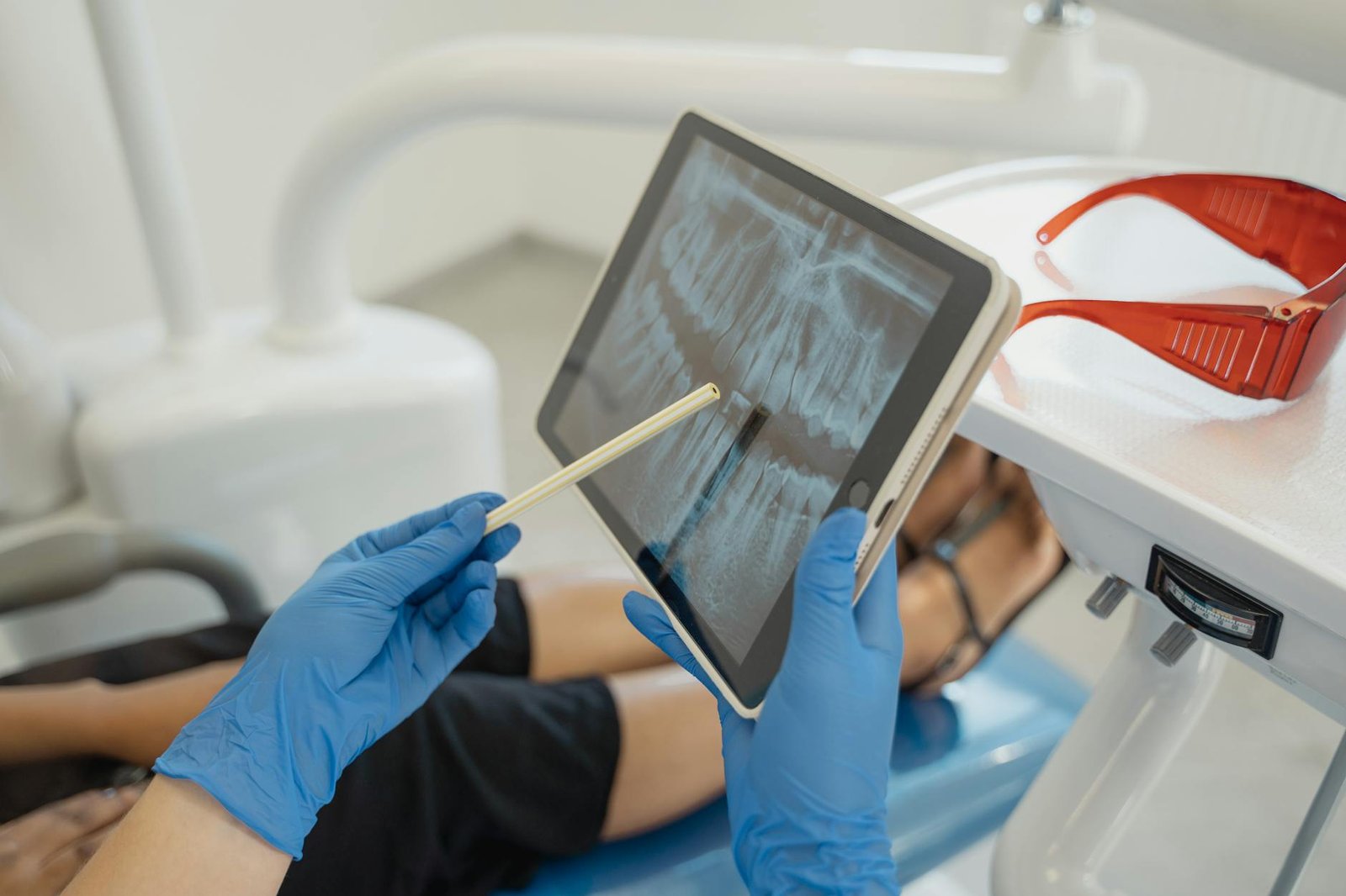 Illustration of Root Canal Mohali: Must-Have RCT Dentist in Sahibzada Ajit Singh Nagar